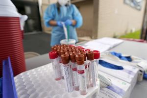 U Istri dva nova slučaja zaraze koronavirusom