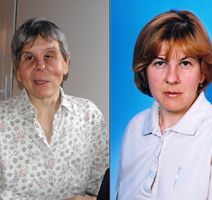 Barbara Načinović, prije i nakon operacije 