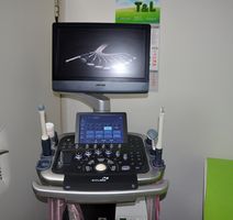 Novi ultrazvučni aparat na ginekologiji